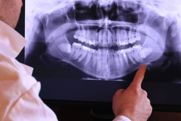 Best Emergency Root Canal Treatment in Temple, TX